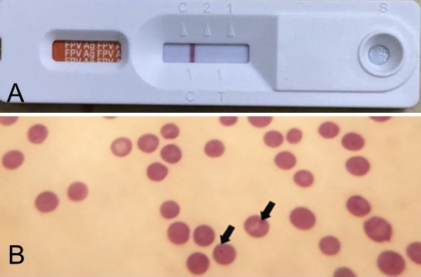 Figure 1. Laboratory findings in a 3-year-old male cat with pre sumptive feline hemotropic mycoplasmosis