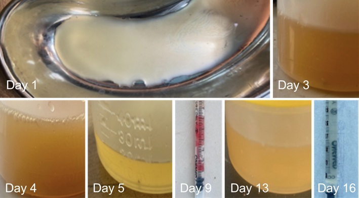 Figure 1. The results of cystocentesis on day 1 and the progression of urination over a two-week treatment period showed gradual improve-ment in urine clarity following therapeutic management