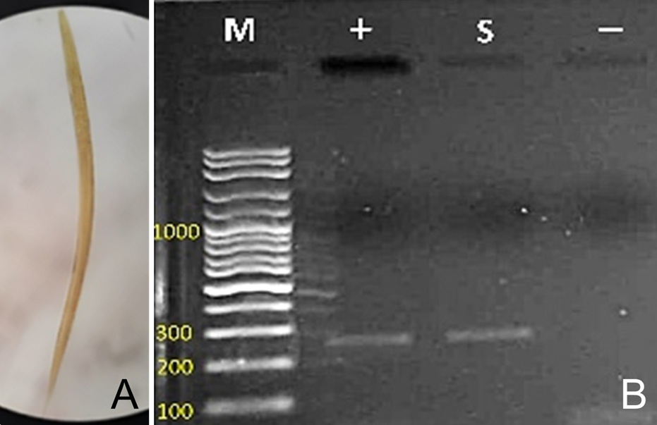 Figure 1. Morphological and molecular identification of Haemonchus contortus larvae from spotted deer. (A) Infective third-stage larvae (L3) from faecal cultures. (B) Agarose gel electrophoresis of PCR products showing the 260 bp amplicon of Haemonchus contortus. M, DNA ladder; +, positive control; S, sample; −, negative control.