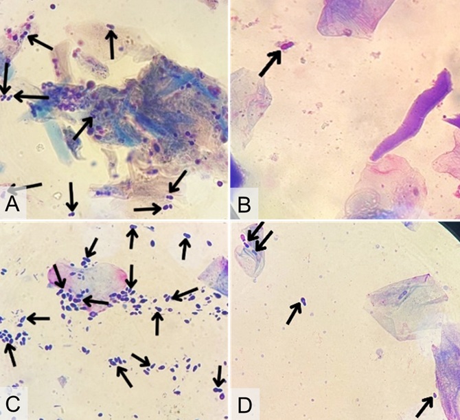 Figure 2. Cytological findings in a pug with malasseziosis and otitis externa: (A) skin sample before treatment showing >8 Malassezia yeasts per field; (B) skin sample after treatment showing 1 Malassezia yeast per field; (C) ear swab before treatment showing >10 Malassezia yeasts and cocci bacteria per field; (D) ear swab after treatment show-ing 4 Malassezia yeasts with no cocci bacteria (1000×).