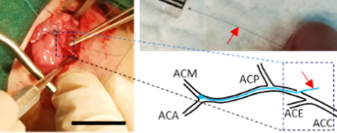Figure 1 Middle cerebral artery occlusion (MCAO) procedure