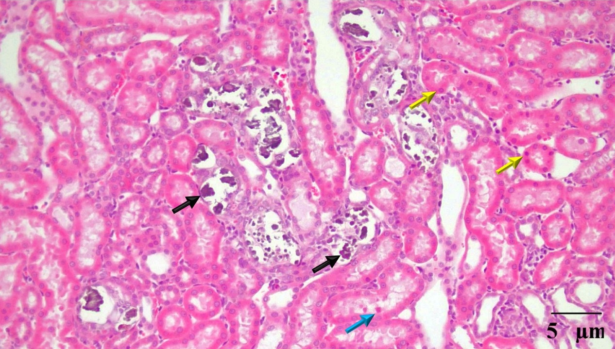 Figure 1. Renal histology after EG–NH₄Cl exposure. Black arrows, intratubular deposits; yellow arrows, tubular epithelial necrosis; blue arrows, hyaline casts. Haematoxylin and eosin