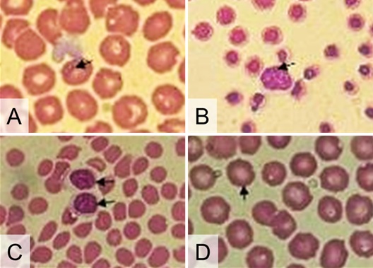 Figure 2. Blood smear showing Babesia in erythrocytes and Ehrlichia in monocytes. (A) Babesia (black arrow); (B) Ehrlichia in monocytes (black arrow); (C) no morulae in monocytes; (D) no intraerythrocytic parasites. 1000× magnification