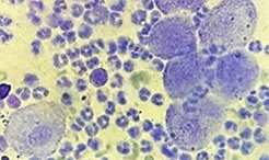Figure 1. Cytological features of preputial exudate from a dog with canine transmissible venereal tumor (CTVT), stained with Wright–Giemsa and examined at ×400 magnification
