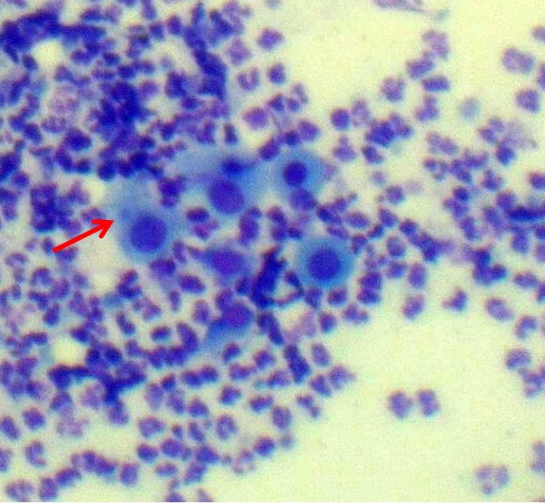 Figure 1. Cytological features of ocular exudate from a cat with presumptive Chlamydia felis-associated conjunctivitis. Diff-Quick stain, x400 magnification. Red arrows indicate basophilic intracytoplasmic inclusion bodies within conjunctival epithelial cells